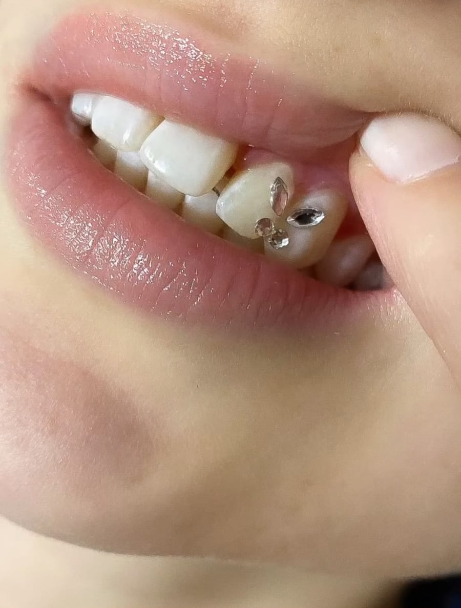 Lächeln mit Zahnschmuck aus Navette- und runden Kristallen